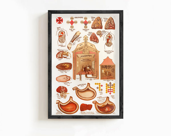 Vintage Sanitation and Hygiene promotion poster chart, science anatomy, human lungs and alcohol effects | Clinic Decor Wall Art